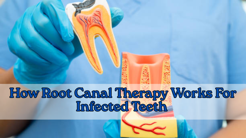 How Root Canal Therapy Works For Infected Teeth